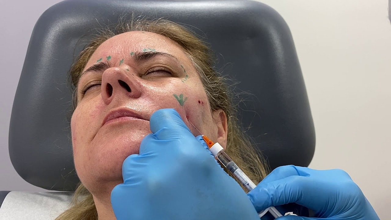 Administering injection during facial treatment procedure.