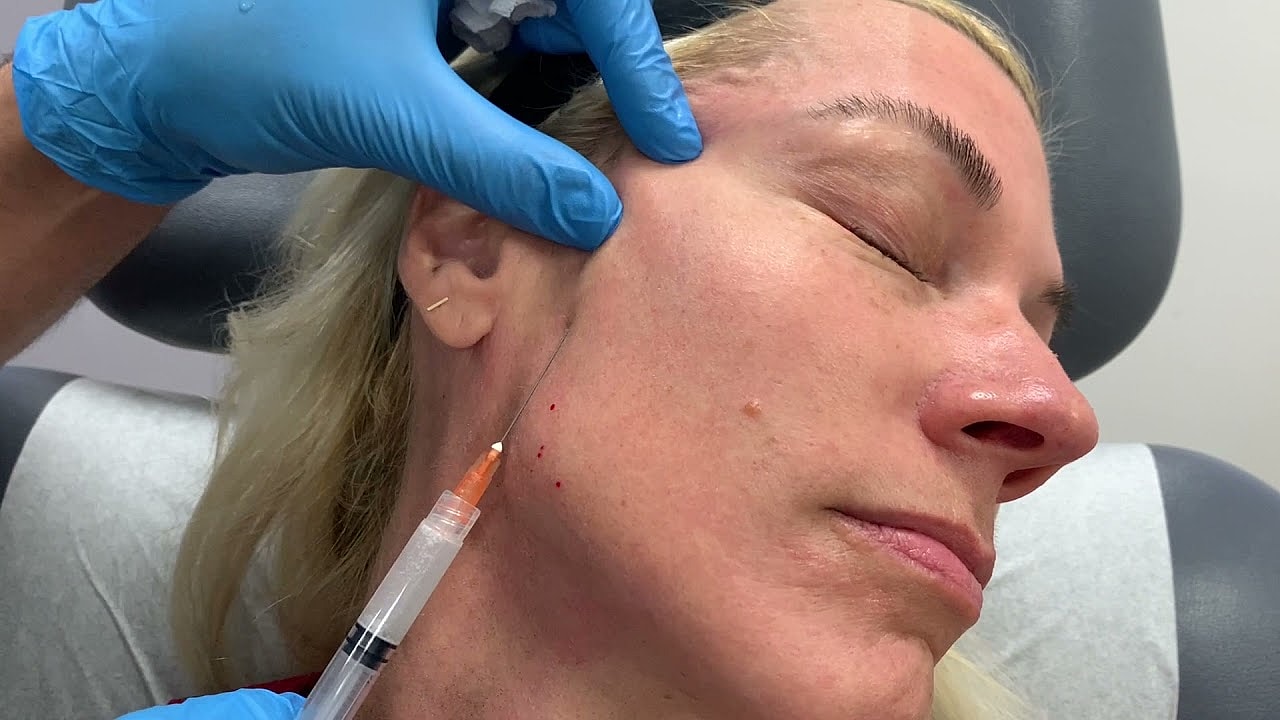 Patient receiving cosmetic injection in clinic setting.