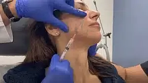 Administering injection for facial treatment.