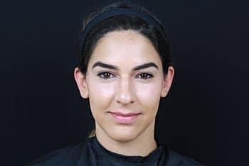 Dermal Fillers Before & After