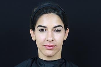 Dermal Fillers Before & After