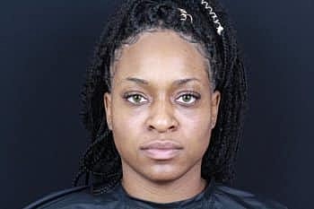 Dermal Fillers Before & After