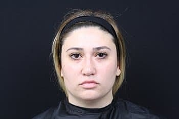 Dermal Fillers Before & After