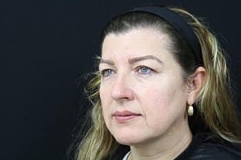 Dermal Fillers Before & After