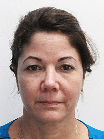 Dermal Fillers Before & After