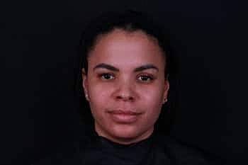 Botox & Dysport Before & After