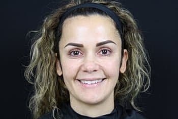 Botox & Dysport Before & After