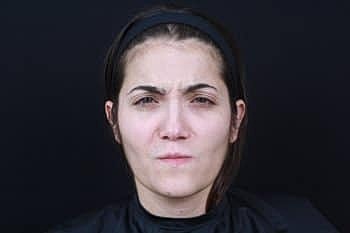 Botox & Dysport Before & After