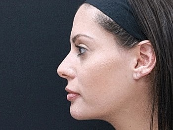 Profile view of a woman with a headband.