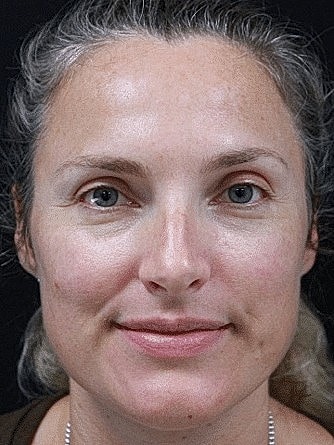 Smiling woman with light skin and grey hair.