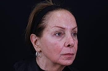 Woman with a neutral expression against a dark background.