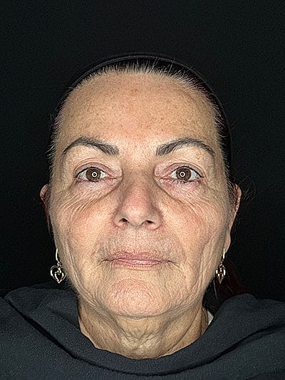 Elderly woman with neutral expression and earrings.