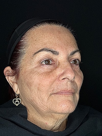 Woman with earrings against a dark background.