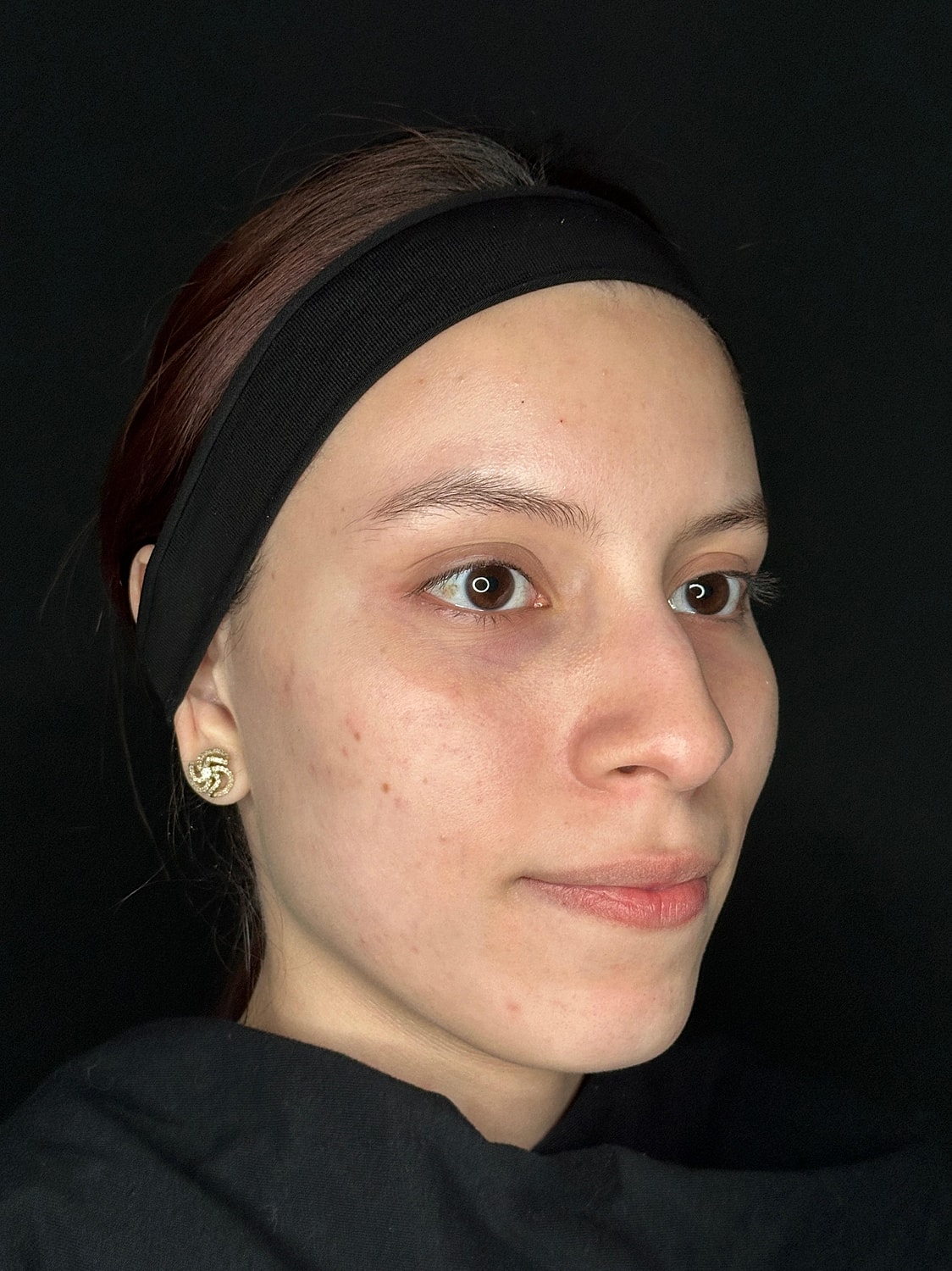 IPL Before & After