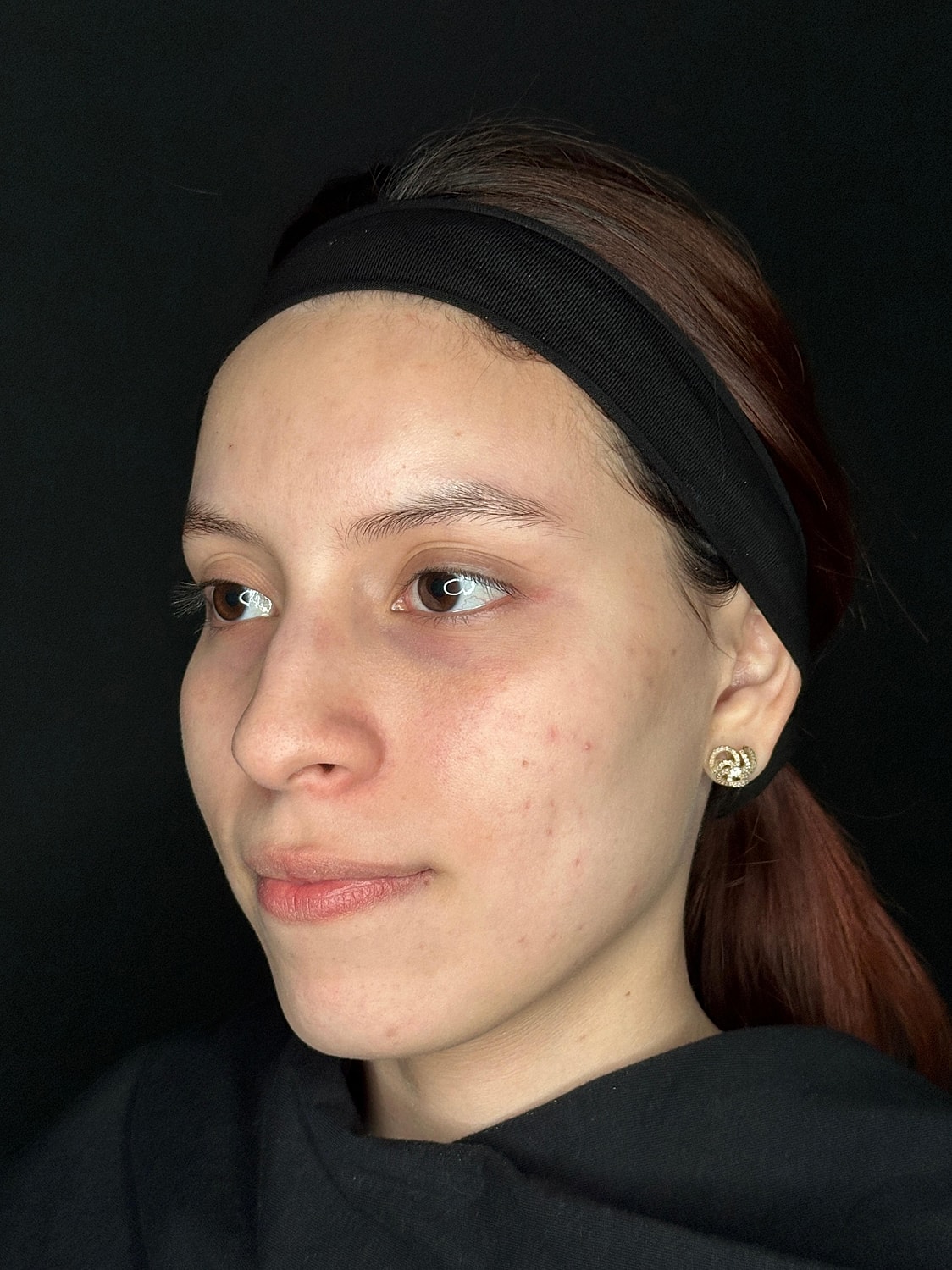 IPL Before & After