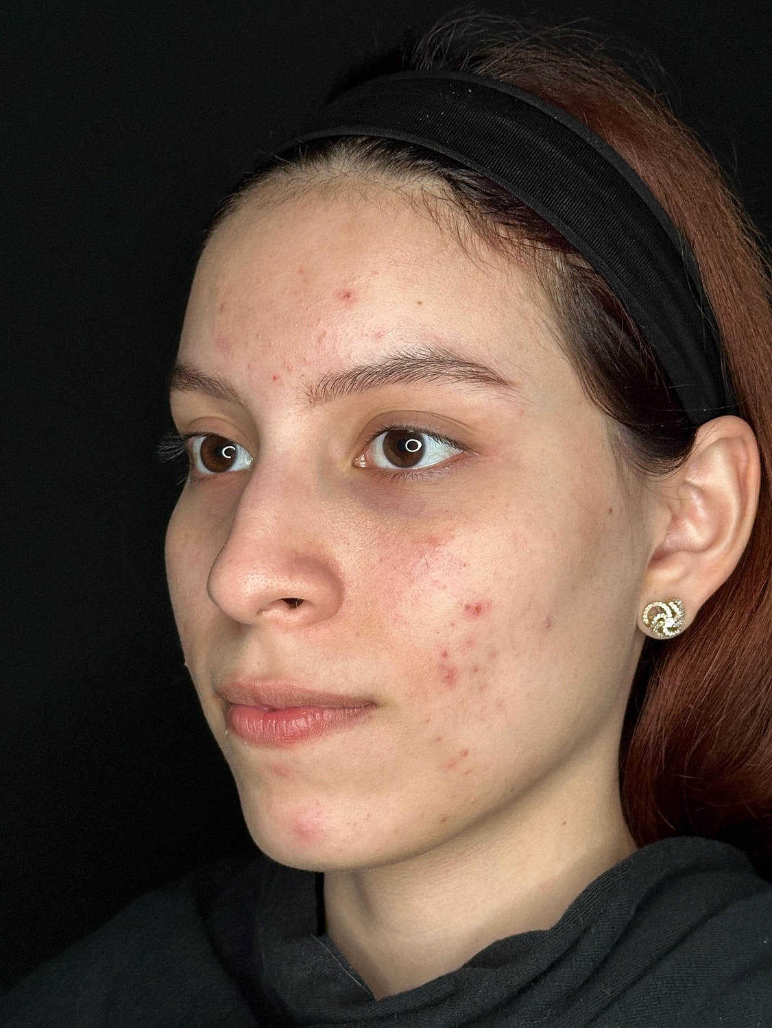 IPL Before & After