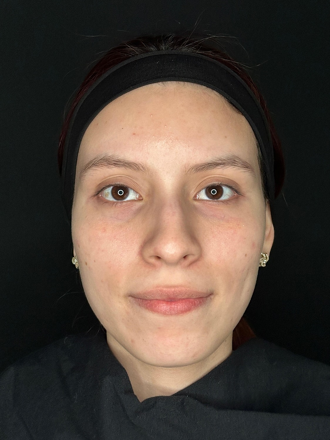 IPL Before & After