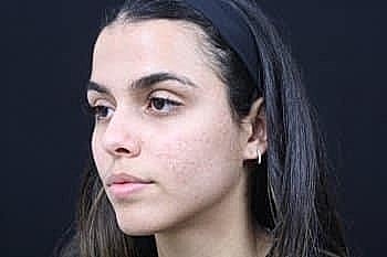 Profile of a young woman against dark background.