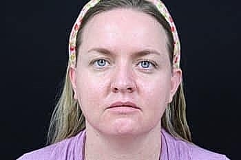 Woman with neutral expression and floral headband.