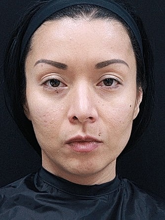 Woman with minimal makeup, serious expression.