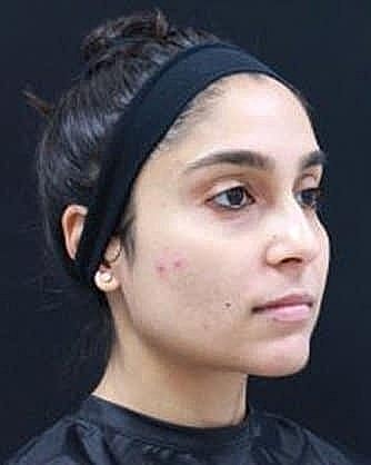 Woman with a headband and natural makeup.