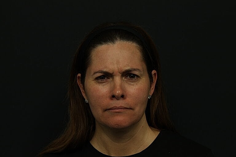 Woman with a serious expression against dark background.