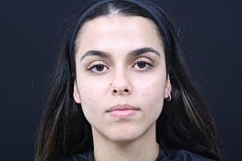 Skin Rejuvenation Before & After