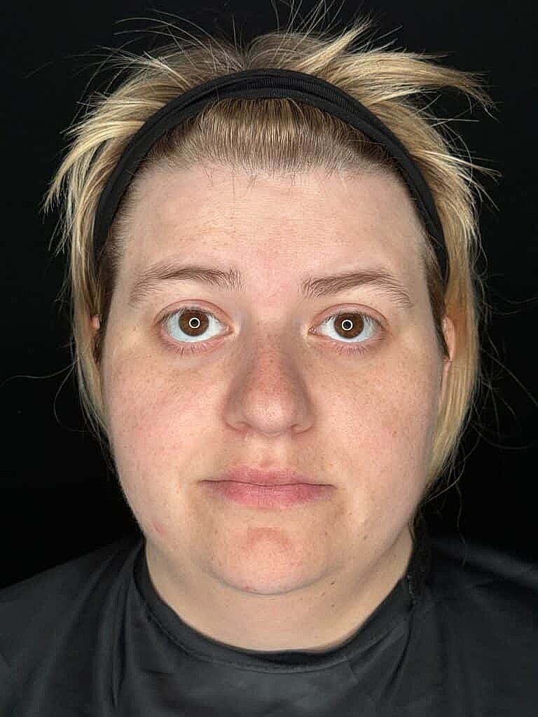 Person with light hair and serious expression.