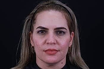 Woman with light hair and neutral expression.