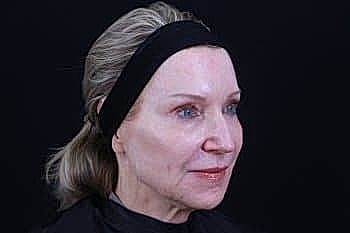 Older woman with a neutral expression against black background.