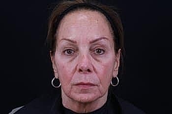 Neutral portrait of an older woman.