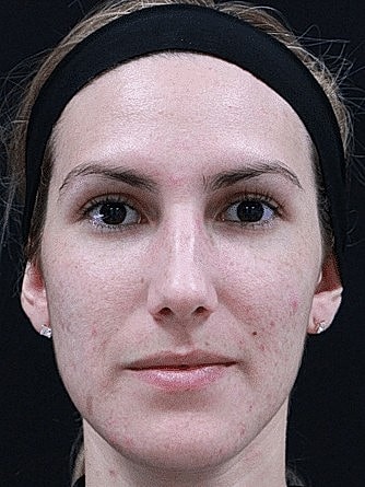 Close-up portrait of a woman with headband.