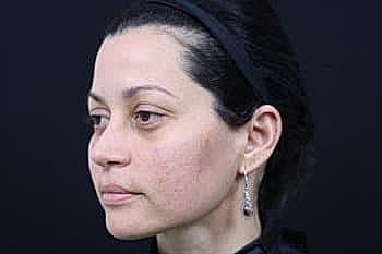 Profile of a woman with natural beauty.