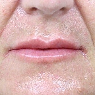 Close-up of lips and chin area.