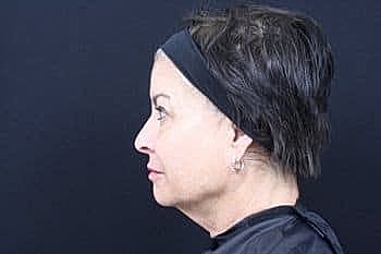 Woman's profile with short hair and headband.
