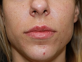 Close-up of a woman's lips and chin.
