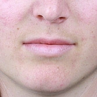 Close-up of human lips and chin.