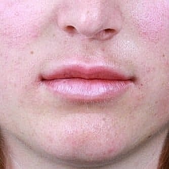 Close-up of lips and skin texture.