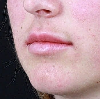Close-up of a woman's lips and chin.