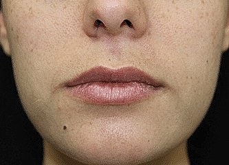 Close-up of lips and chin area.