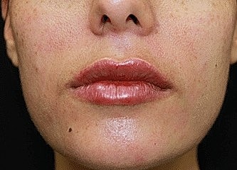Close-up of lips with natural makeup sheen.