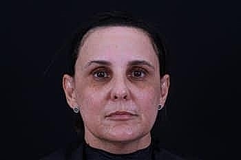 Person with a neutral expression against dark background.