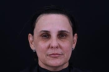 Neutral expression portrait against dark background.