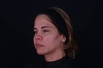 Woman with medium-length hair, side profile view.