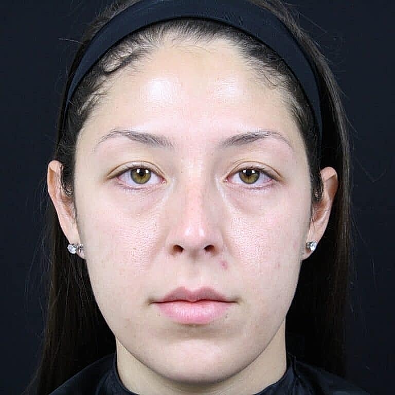 Neutral expression portrait on black background.