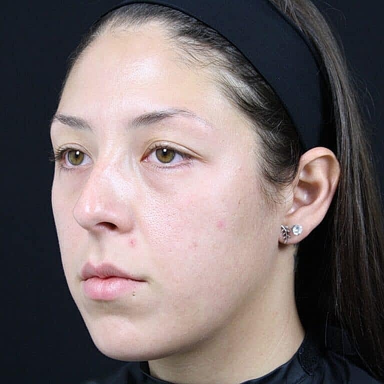 Person with natural makeup against a black background.