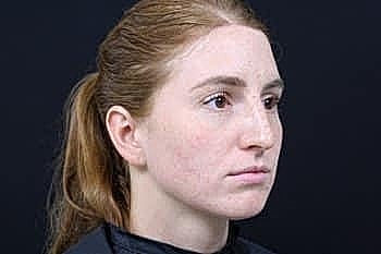 Profile of a young woman with red hair.