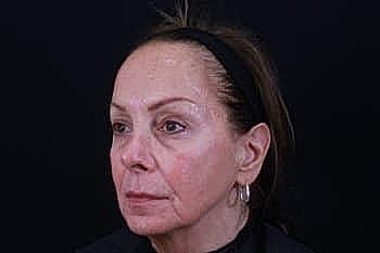 Woman with natural makeup against a dark background.