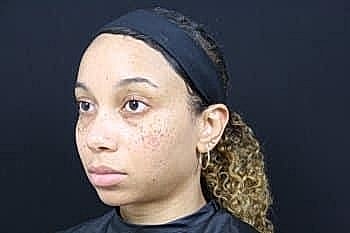 Person with curly hair and headband, profile view.