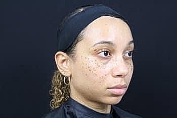 Woman with freckles and curly hair, profile view.